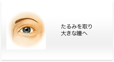 上眼瞼切開